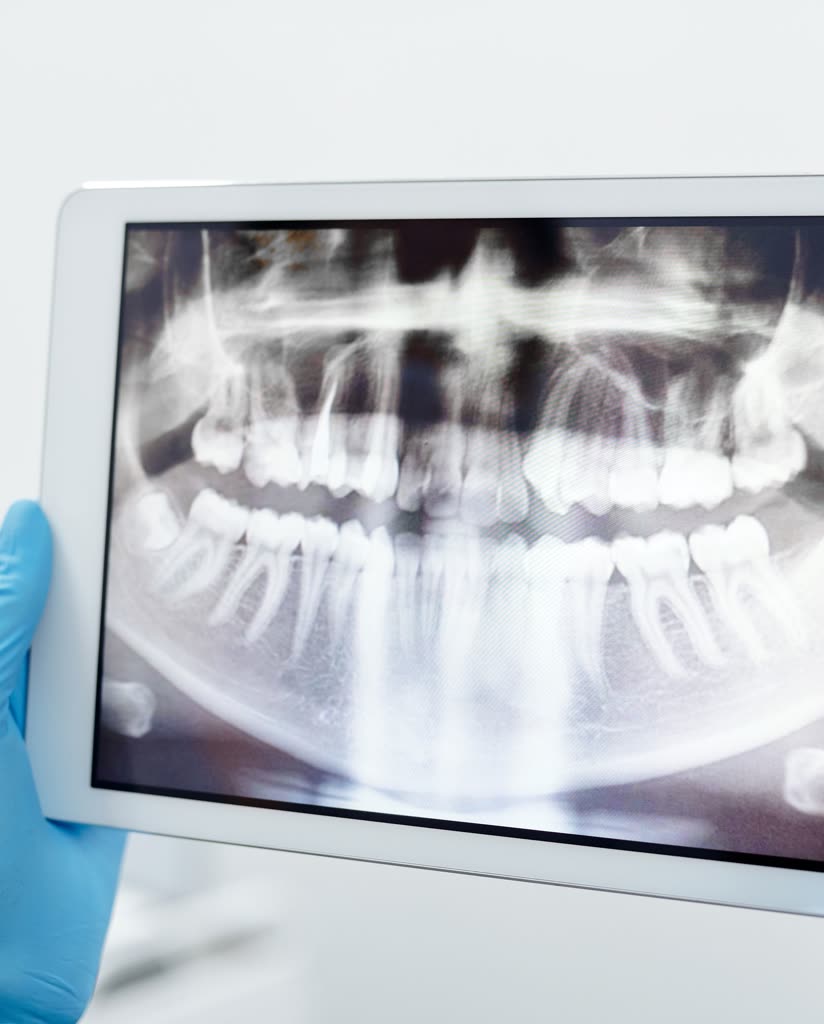 A panoramic X-ray reviewed on a tablet