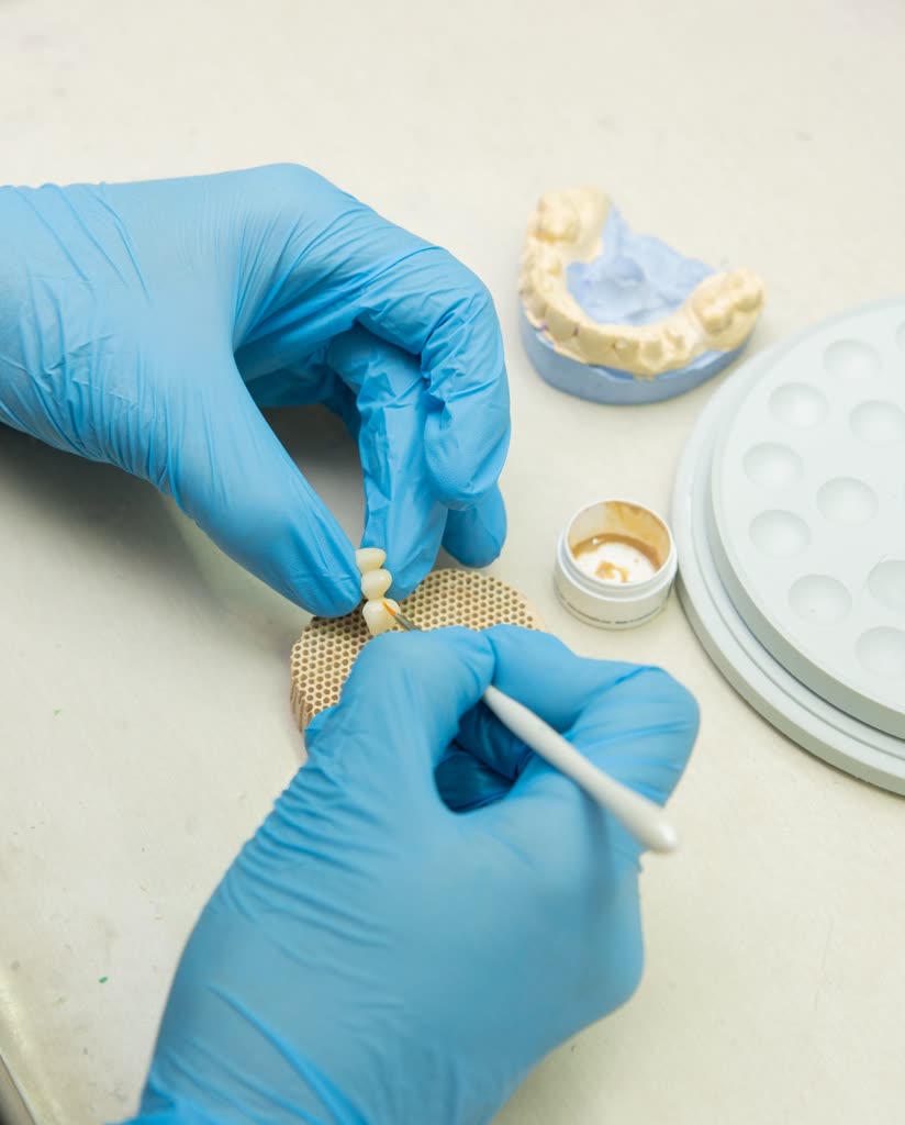 Finishing a crown by hand at the in-office bench