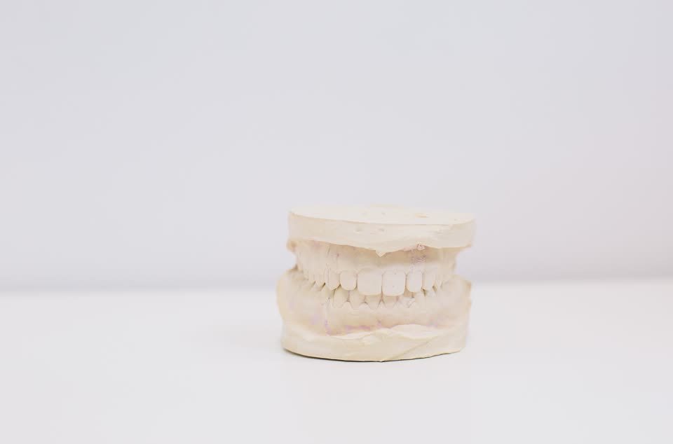 A plaster model for a night guard