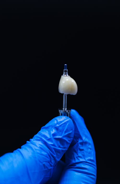 A milled ceramic crown held up before glazing