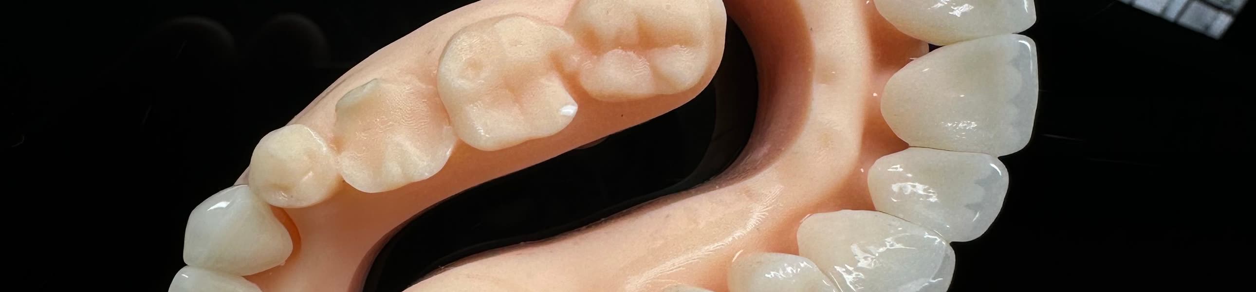 A full arch of ceramic crowns on a light box
